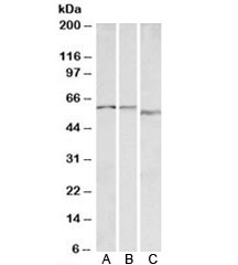 Western blot testing of A) human, B) mouse and C) rat heart lysate with ADRA1B antibody at 0.1ug/ml. Predicted molecular weight: ~57kDa.~
