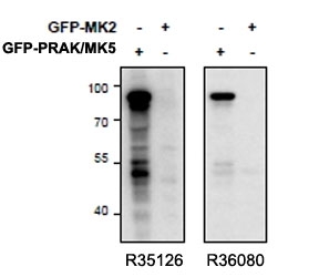 Western blot of HEK293 lysate overexpressing mouse MK5/PRAK (first lane) or mouse MK2 (second lane) tested with right ) PRAK antibody (cat # R36080, 0.5ug/ml) and left) PRAK antibody (<a href=../tds/prak-antibody-r35126>cat # R35126</a>, 0.5ug/ml). No cross-reaction seen with MK2 protein.