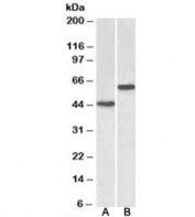 Western blot testing of human cerebellum [A] and liver [B] lysates with LYVE1 antibody at 2ug/ml. Image shows different glycosylated forms of the predicted ~35kDa protein.