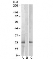 Western blot testing of HEK293 lysate overexpressing human CST8-MYC probed with Cystatin 8 antibody [1ug/ml] in Lane A and anti-MYC [1/1000] in lane C. Mock-transfected HEK294 probed with Cystatin 8 antibody [1ug/ml] in Lane B.