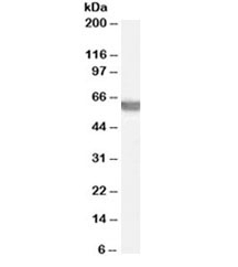 Western blot testing of human testis lysate with G6PD antibody at 0.03ug/ml. Predicted molecular weight ~59kDa.