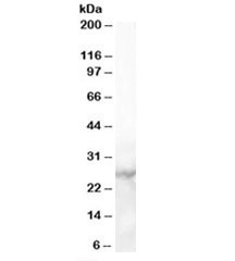 Western blot testing of human heart lysate with MBL2 antibody at 1ug/ml. Predicted/observed molecular weight: ~26kDa.