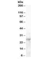 Western blot testing of human heart lysate with MBL2 antibody at 1ug/ml. Predicted molecular weight: ~26 kDa.