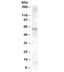 Western blot testing of human muscle lysate with KPNA6 antibody at 0.1ug/ml. Predicted molecular weight: ~60kDa.~