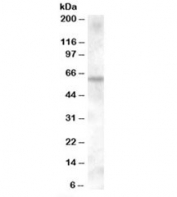 Western blot testing of human muscle lysate with KPNA6 antibody at 0.1ug/ml. Predicted molecular weight: ~60kDa.