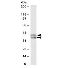 Western blot testing of human liver lysate with HP antibody at 0.1ug/ml. Predicted molecular weight: ~38-45kDa. Image shows beta chain isoform 1 and 2 being detected.~