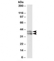Western blot testing of human liver lysate with HP antibody at 0.1ug/ml. Predicted molecular weight: ~38-45kDa. Image shows beta chain isoform 1 and 2 being detected.