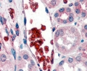 IHC staining of erythrocytes in FFPE human kidney tissue with Glycophorin A antibody at 2ug/ml. HIER: steamed with pH6 citrate buffer, AP-staining.