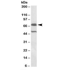 Western blot testing of rat testis lysate with BIRC3 antibody at 1ug/ml. Predicted/observed molecular weight (rat): ~71 kDa.