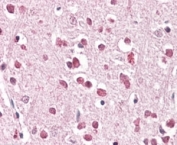 IHC staining of FFPE human cerebral cortex with XAB2 antibody at 4ug/ml. HIER: steamed with pH6 citrate buffer, AP-staining.