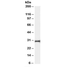 Western blot testing of human thymus lysate with HVEM antibody at 0.03ug/ml. Expected molecular weight: 30-38 kDa depending on glycosylation level.~