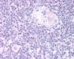IHC testing of FFPE human thymus medulla with FOXN1 antibody at 20ug/ml. HIER: steamed with pH6 citrate buffer, AP-staining.