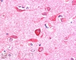 IHC testing of FFPE human cerebral cortex with PITPNM3 antibody at 5ug/ml. HIER: steamed with pH6 citrate buffer, AP-staining.