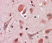 IHC staining of FFPE human cortex with HIP2 antibody at 4ug/ml. HIER: steamed with pH6 citrate buffer, AP-staining.