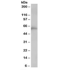 Western blot testing of human lung lysate with TCP1 antibody at 1ug/ml. Predicted/observed molecular weight: ~60kDa.~
