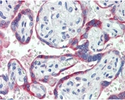 IHC staining of FFPE human placenta with NOX2 antibody at 3.8ug/ml. HIER: steamed with pH6 citrate buffer, AP-staining.