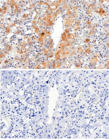 IHC testing of FFPE human adrenal gland tissue with VMAT2 antibody at 2.5ug/ml. Required HIER: steamed antigen retrieval with pH6 citrate buffer; HRP-staining.