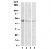 Western blot testing of human 1) placenta, 2) uterus, 3) adrenal gland and 4) pancreas lysate with VMAT2 antibody at 1ug/ml. Predicted molecular weight: ~55 kDa.