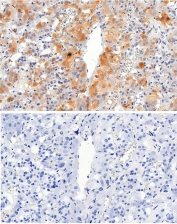 IHC testing of FFPE human adrenal gland tissue with VMAT2 antibody at 2.5ug/ml. Required HIER: steamed antigen retrieval with pH6 citrate buffer; HRP-staining.
