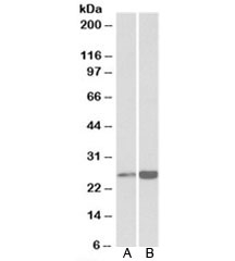 Western blot testing of human heart [A] and liver [B] lysates with Peroxiredoxin 6 antibody at 0.3ug/ml. Expected molecular weight: ~25kDa.~