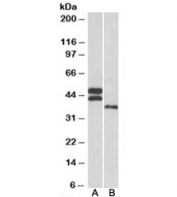 Western blot testing of human heart [A] and liver [B] lysates with FCRL1 antibody at 0.3ug/ml. Isoforms 1-3 (40-47kDa) may be detected.