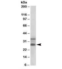 Western blot testing of human skin lysate with C16orf57 antibody at 0.3ug/ml. Predicted molecular weight: ~30/21kDa (isoforms 1/3).~
