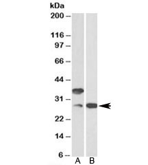 Western blot of mouse (A) and rat (B) skin lysates with C16orf57 antibody at 0.1ug/ml.