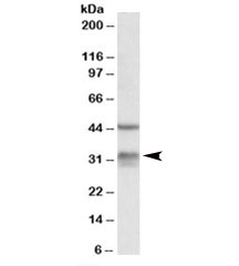 Western blot testing of mouse lung lysate with Hsd11b1 antibody at 0.3ug/ml. The expected ~32kDa band and the additional ~45kDa band are both blocked by the immunizing peptide.~