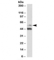 Western blot testing of human colorectal cancer lysate with PYROXD1 antibody at 1ug/ml. Predicted/observed molecular weight ~56kDa. The ~48kDa band is likely a breakdown product.