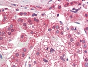 IHC testing of FFPE human adrenal gland tissue with TGFBR1 antibody at 5ug/ml. Required HIER: steamed antigen retrieval with pH6 citrate buffer; AP-staining.