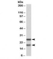 Western blot testing of PBMC lysate with SNAP23 antibody at 0.2ug/ml. Expected molecular weight: ~23/18kDa (isoforms 1/2).