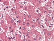 IHC testing of FFPE human liver tissue with APOB antibody at 2ug/ml. Required HIER: steamed antigen retrieval with pH6 citrate buffer; AP-staining.