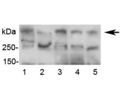 Western blot testing of human serum lysate (five donors) with APOB antibody at 0.5ug/ml