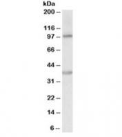 Western blot testing of human liver lysate with ZEB2 antibody at 0.2ug/ml. Predicted molecular weight ~136kDa. The observed ~100 and ~38kDa bands are possible breakdown fragments.