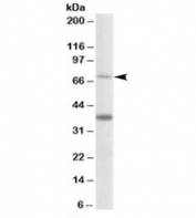 Western blot testing of human liver lysate with CPT2 antibody at 0.5ug/ml. Predicted molecular weight: ~74kDa.