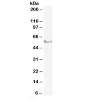 Western blot testing of pig ovary lysate with LRH1 antibody at 0.3ug/ml. Predicted molecular weight (pig): ~56kDa.