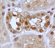 IHC testing of FFPE human kidney with SGK1 antibody at 2ug/ml. HIER: steamed with pH6 citrate buffer, HRP-staining.