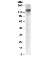 Western blot testing of nuclear HeLa lysate with DHX9 antibody at 1ug/ml. Predicted molecular weight: ~140kDa.