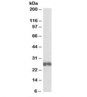 Western blot testing of Jurkat lysate with D4-GDI antibody at 0.1ug/ml. Predicted molecular weight: ~23kDa.