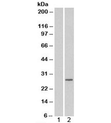 Western blot of HEK293 lysate overexpressing RAB11A and probed with RAB11A antibody (mock transfection in lane 1). Predicted molecular weight: ~