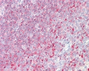 IHC testing of FFPE human spleen tissue with TPD52 antibody at 3.75ug/ml. Required HIER: steamed antigen retrieval with pH6 citrate buffer; AP-staining.