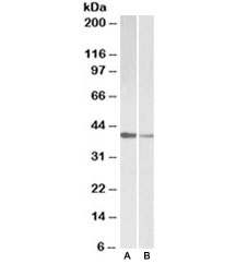 Western blot testing of human [A] and mouse [B] heart lysate with TNNT2 antibody at 0.1ug/ml~