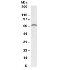 Western blot testing of Daudi lysate with RFX5 antibody at 2ug/ml. Predicted molecular weight (human): ~65kDa.~