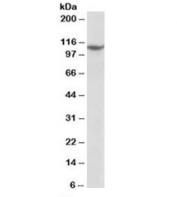 Western blot testing of Jurkat nuclear lysate with PRPF6 antibody at 1ug/ml. Predicted molecular weight: ~107kDa.