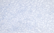 Negative control: IHC staining of FFPE human kidney tissue without primary antibody. HIER: steamed with pH6 citrate buffer, HRP-staining.