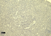Negative control: IHC staining of FFPE human spleen tissue without AIF-1 antibody. Required HIER: steamed antigen retrieval with pH6 citrate buffer.