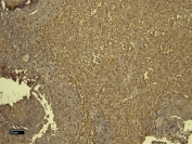 IHC staining of FFPE human spleen tissue with AIF-1 antibody. Required HIER: steamed antigen retrieval with pH6 citrate buffer.