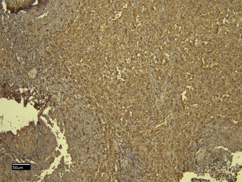 IHC staining of FFPE human spleen tissue with AIF-1 antibody. Required HIER: steamed antigen retrieval with pH6 citrate buffer.
