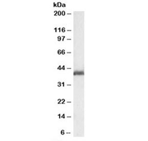Western blot testing of rat ovay lysate with LIS1 antibody at 0.1ug/ml. Predicted molecular weight: 46kDa.