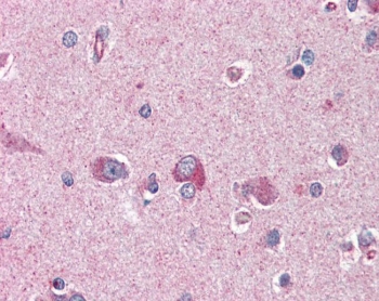 IHC testing of FFPE human cortex (brain) tissue with LIS1 antibody at 3.75ug/ml. Required HIER: steamed antigen retrieval with pH6 citrate buffer; AP-staining.